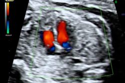 Ecocardiografia fetal